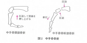 中手骨