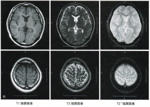 テンソル前比較