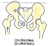 骨盤骨折 恥骨結合離開 仙腸関節脱臼 後遺障害無料相談 秋葉行政書士事務所